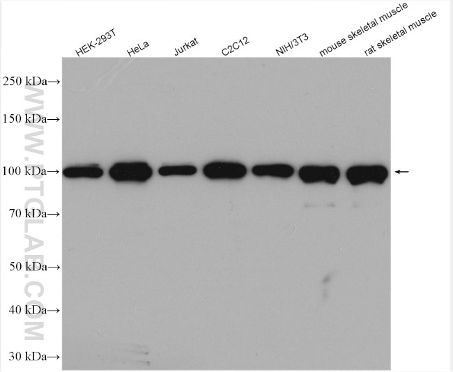 ACTN4 Antibody in Western Blot (WB)