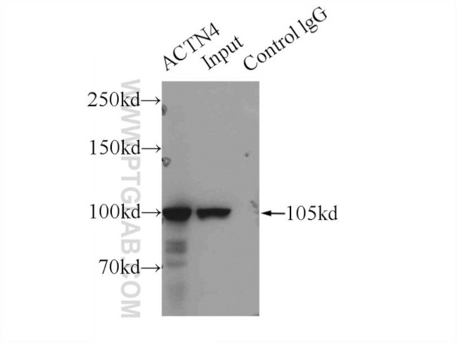 ACTN4 Antibody in Immunoprecipitation (IP)