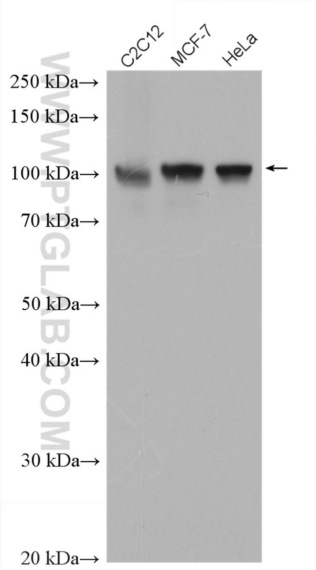 ACTN4 Antibody in Western Blot (WB)