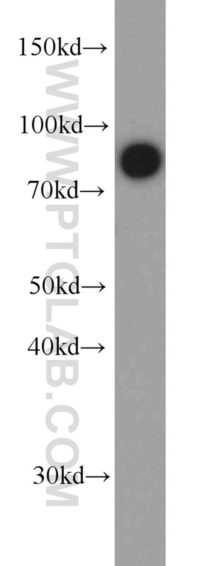 LINGO1 Antibody in Western Blot (WB)