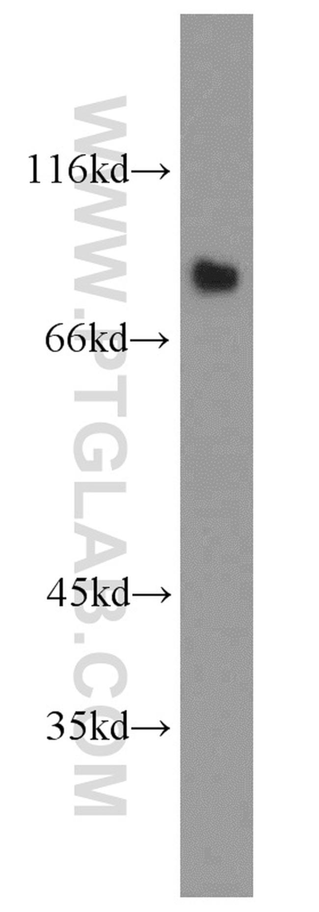 LINGO1 Antibody in Western Blot (WB)