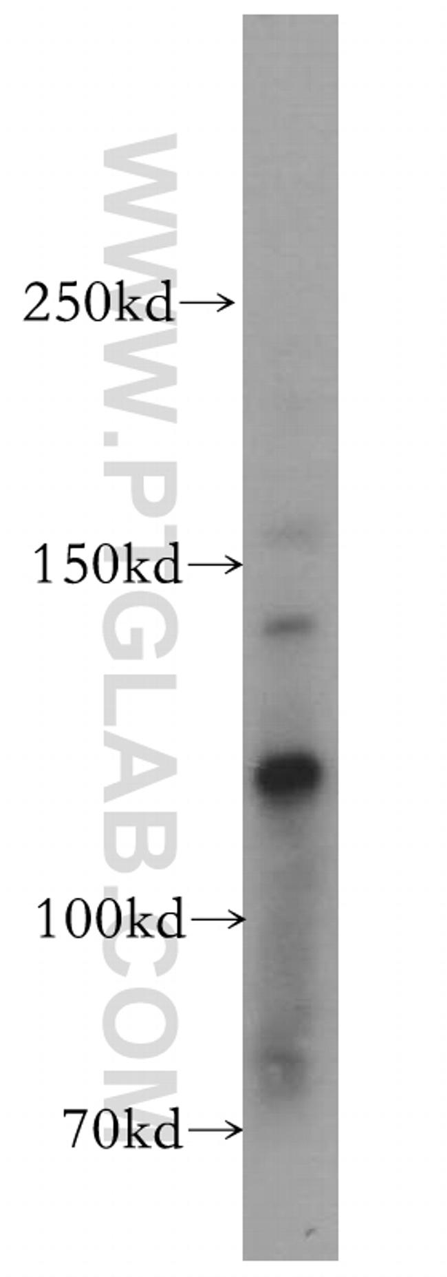 EPAC2 Antibody in Western Blot (WB)