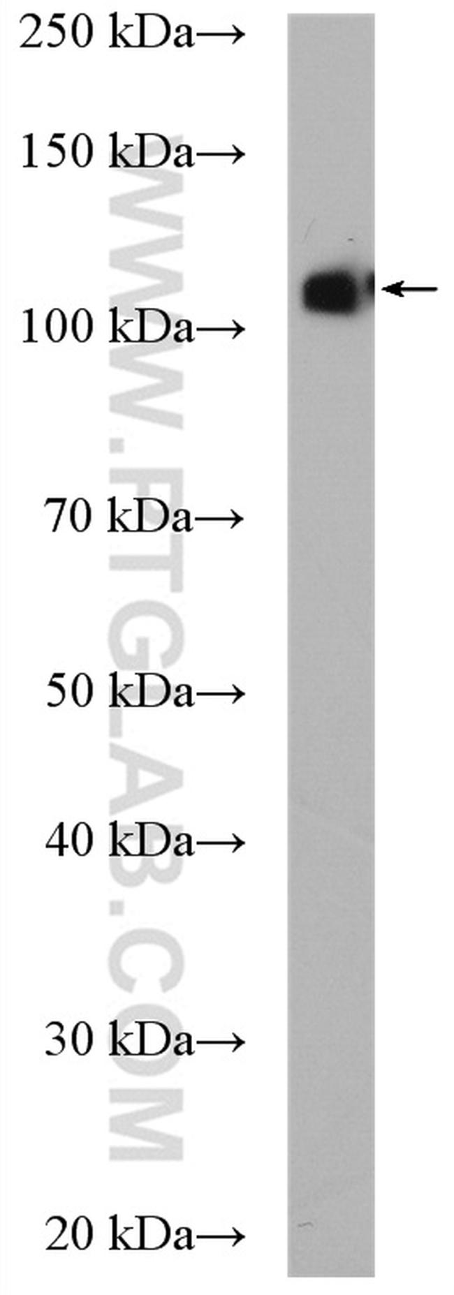 EPAC2 Antibody in Western Blot (WB)