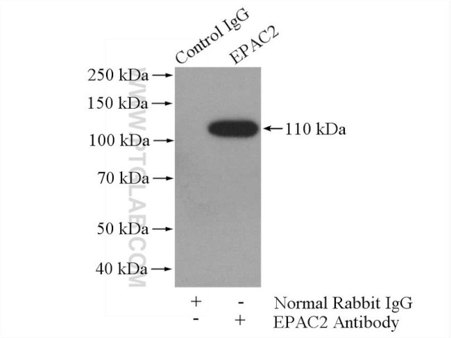 EPAC2 Antibody in Immunoprecipitation (IP)