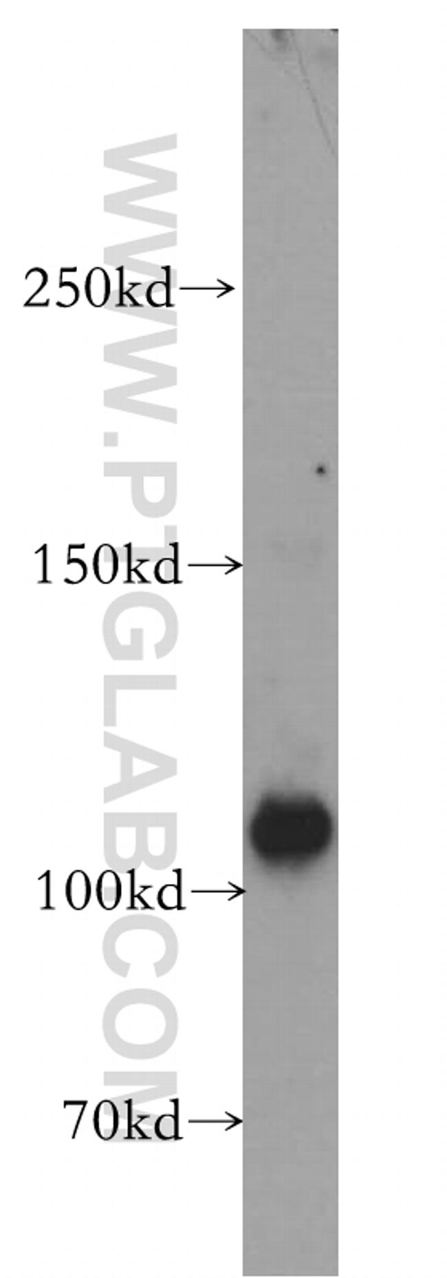 EPAC2 Antibody in Western Blot (WB)