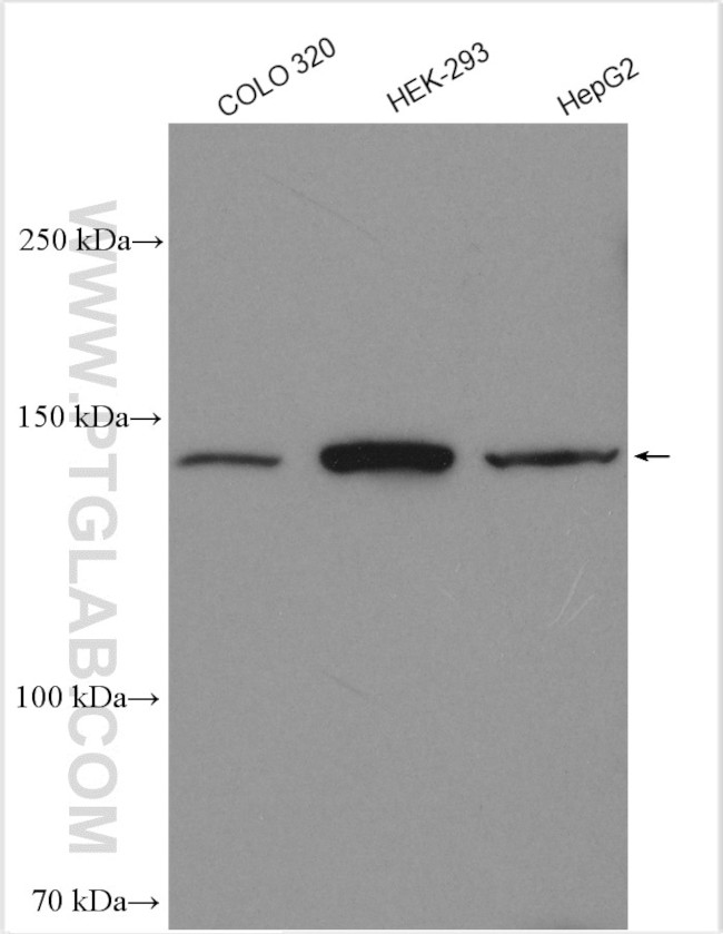 ALPK1 Antibody in Western Blot (WB)