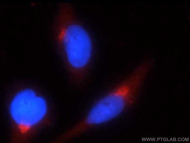 GOLPH3 Antibody in Immunocytochemistry (ICC/IF)