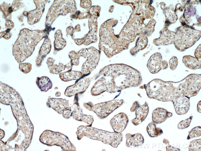 GOLPH3 Antibody in Immunohistochemistry (Paraffin) (IHC (P))