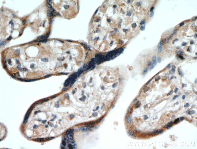 GOLPH3 Antibody in Immunohistochemistry (Paraffin) (IHC (P))