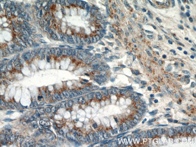 GOLPH3 Antibody in Immunohistochemistry (Paraffin) (IHC (P))