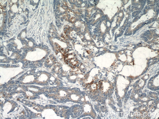 GOLPH3 Antibody in Immunohistochemistry (Paraffin) (IHC (P))