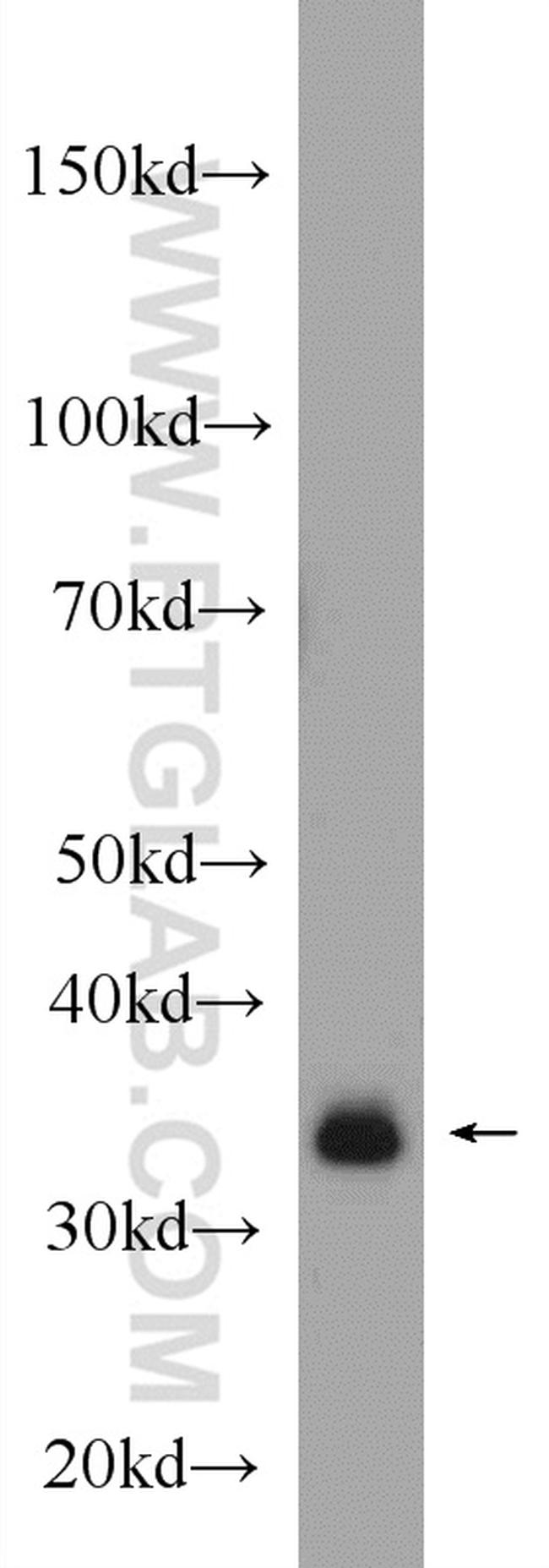 GOLPH3 Antibody in Western Blot (WB)