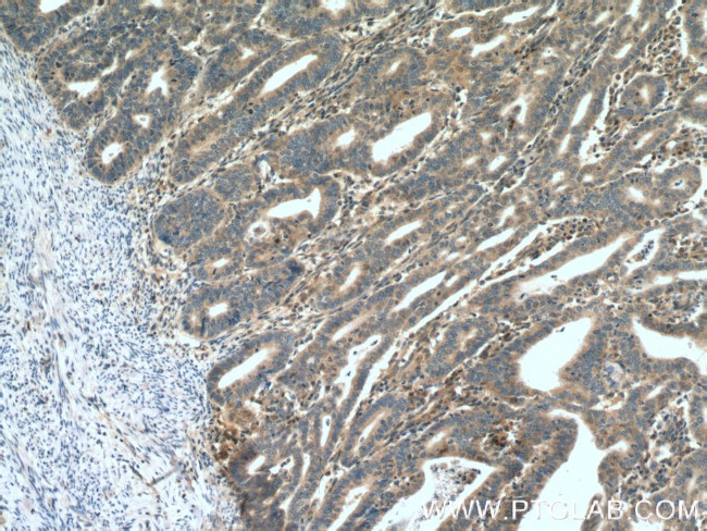 CDK6 Antibody in Immunohistochemistry (Paraffin) (IHC (P))