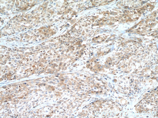 CDK6 Antibody in Immunohistochemistry (Paraffin) (IHC (P))