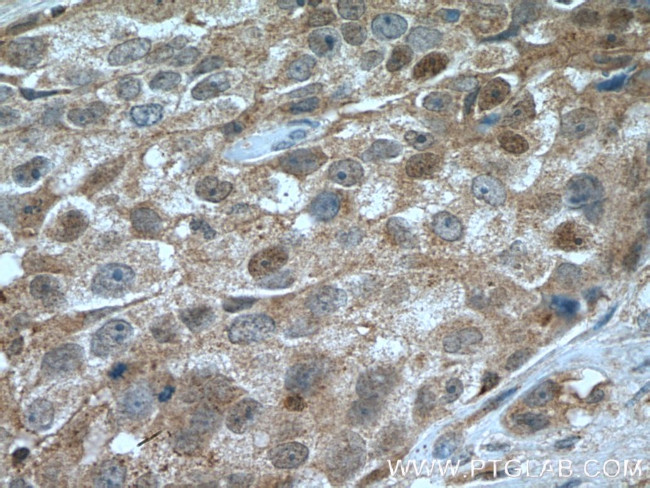 CDK6 Antibody in Immunohistochemistry (Paraffin) (IHC (P))