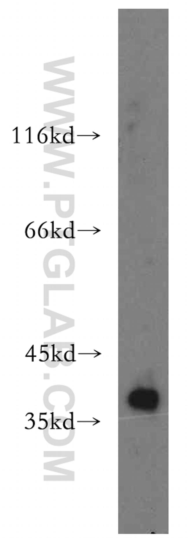 CDK6 Antibody in Western Blot (WB)