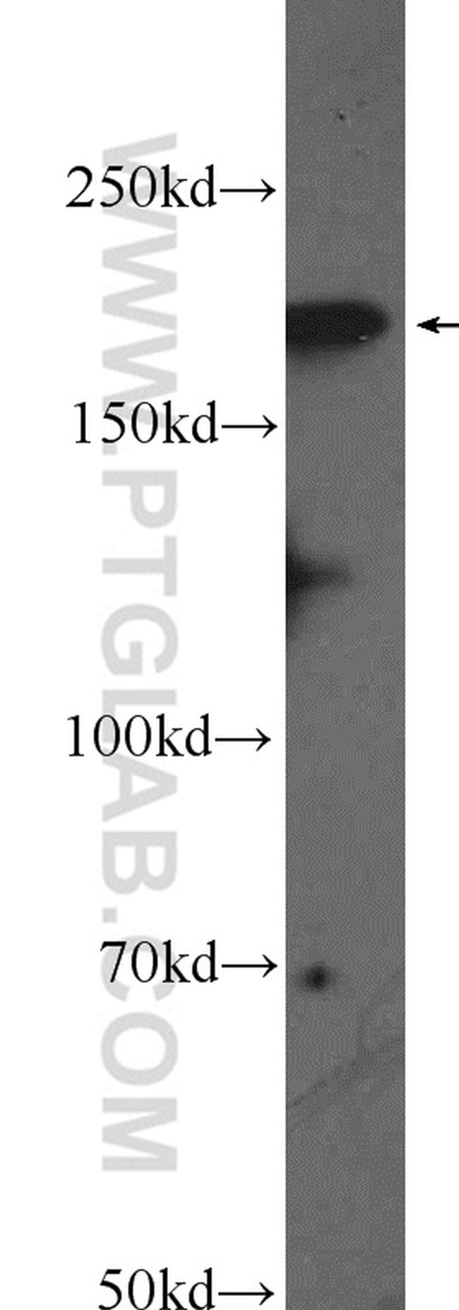 DCC Antibody in Western Blot (WB)