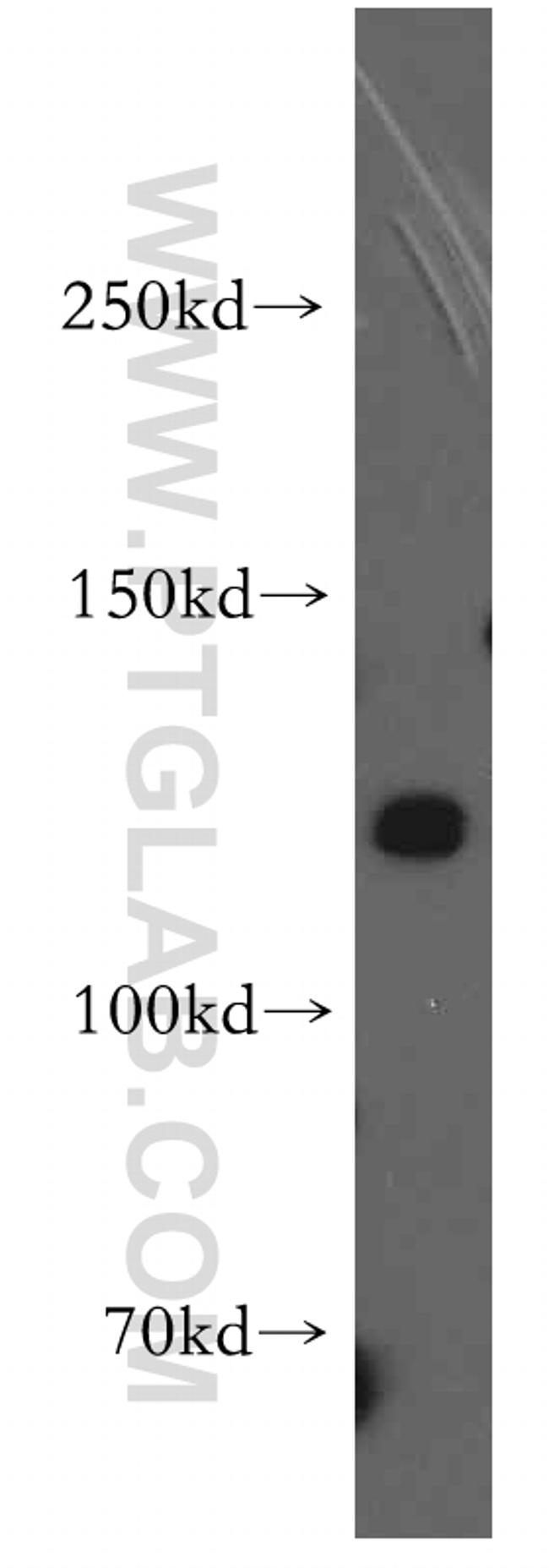 TRPA1 Antibody in Western Blot (WB)