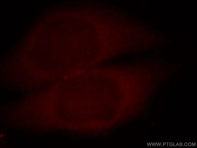 Calcium Sensing Receptor Antibody in Immunocytochemistry (ICC/IF)