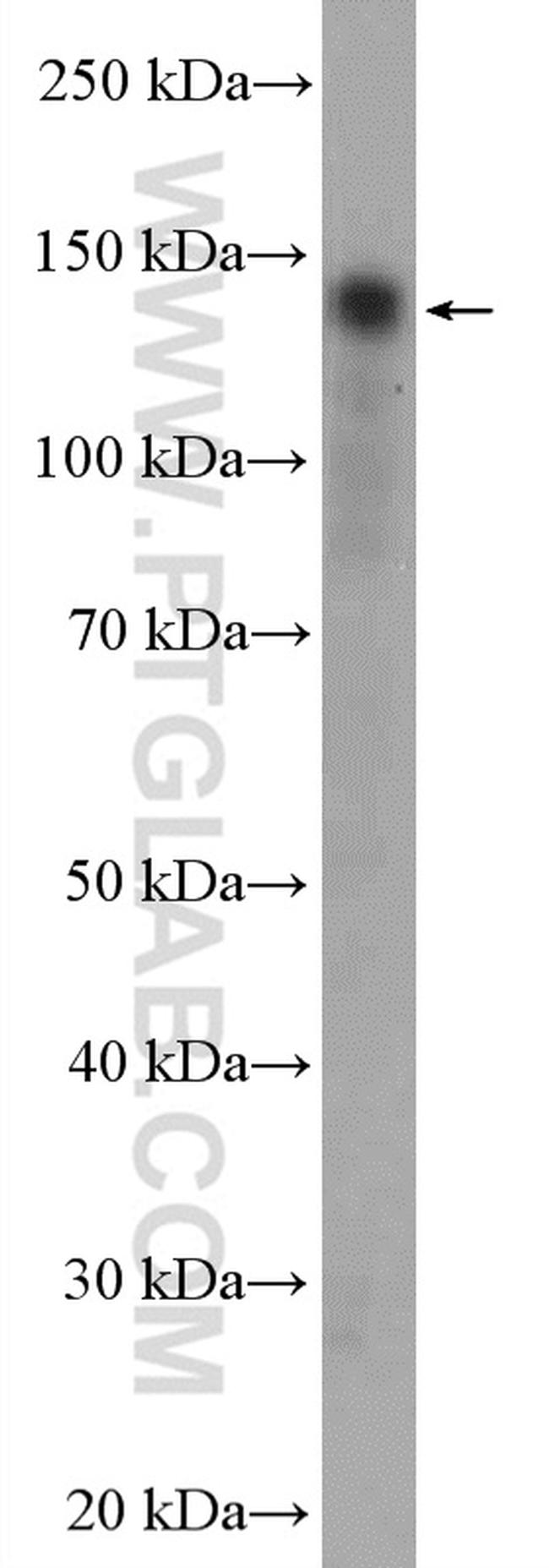 Calcium Sensing Receptor Antibody in Western Blot (WB)