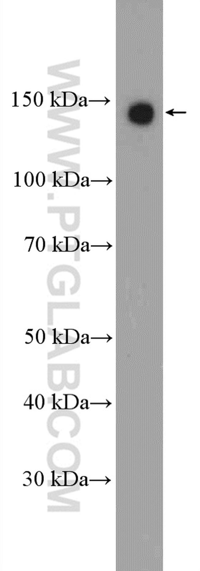 Calcium Sensing Receptor Antibody in Western Blot (WB)