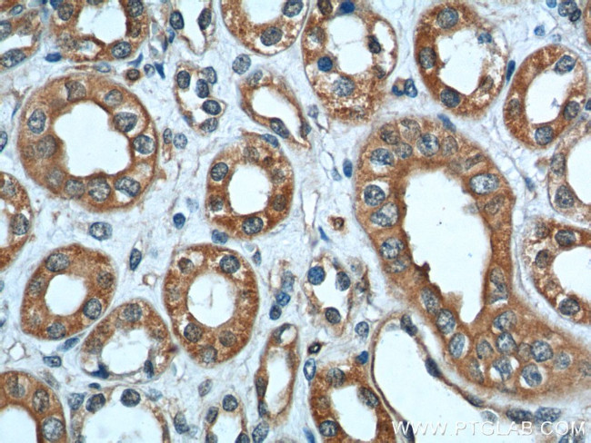 Polycystin 2 Antibody in Immunohistochemistry (Paraffin) (IHC (P))