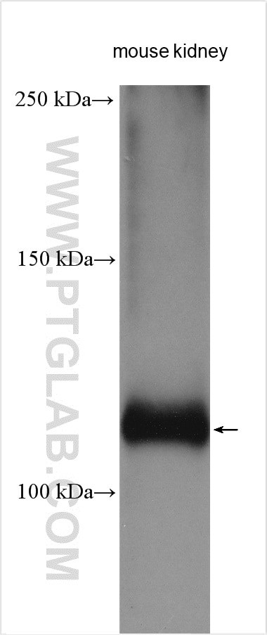 Polycystin 2 Antibody in Western Blot (WB)