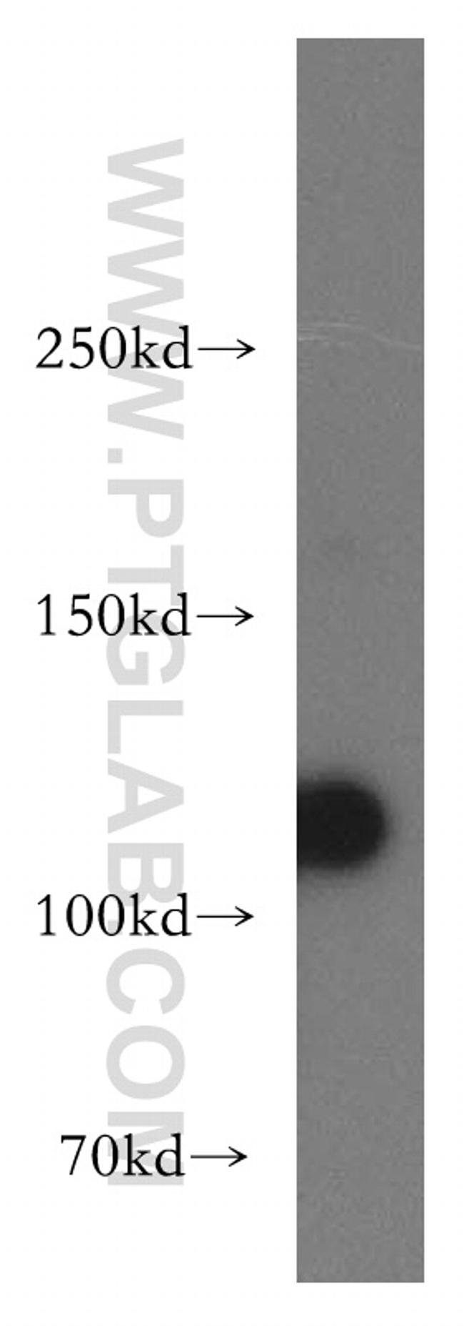 Polycystin 2 Antibody in Western Blot (WB)