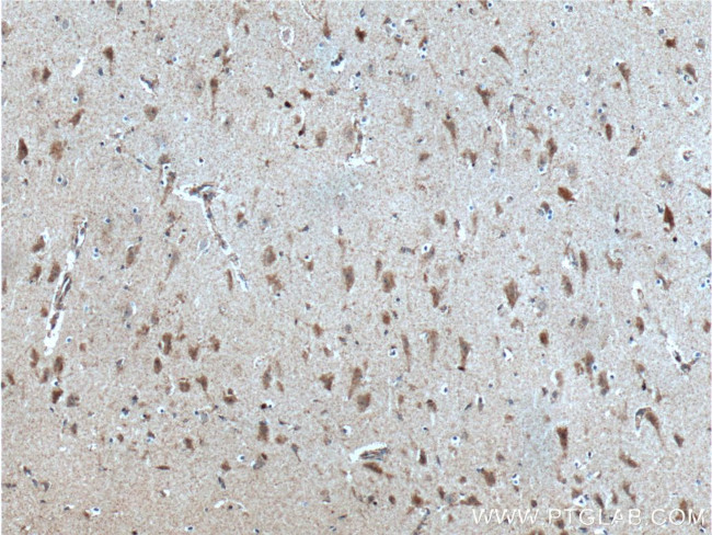 PKC delta Antibody in Immunohistochemistry (Paraffin) (IHC (P))