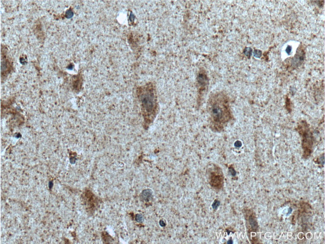 PKC delta Antibody in Immunohistochemistry (Paraffin) (IHC (P))