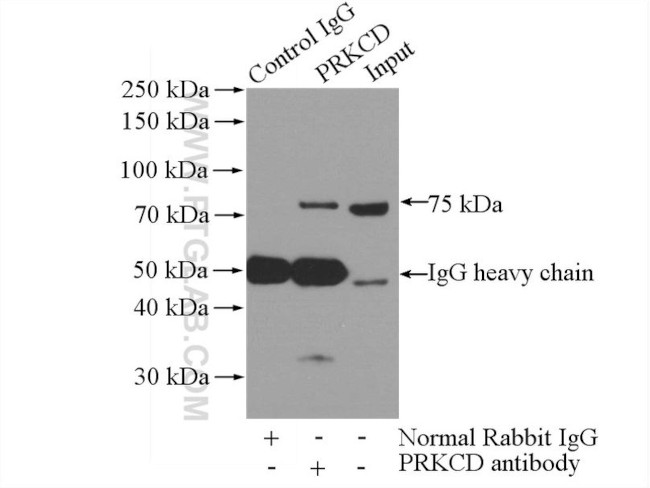 PKC delta Antibody in Immunoprecipitation (IP)