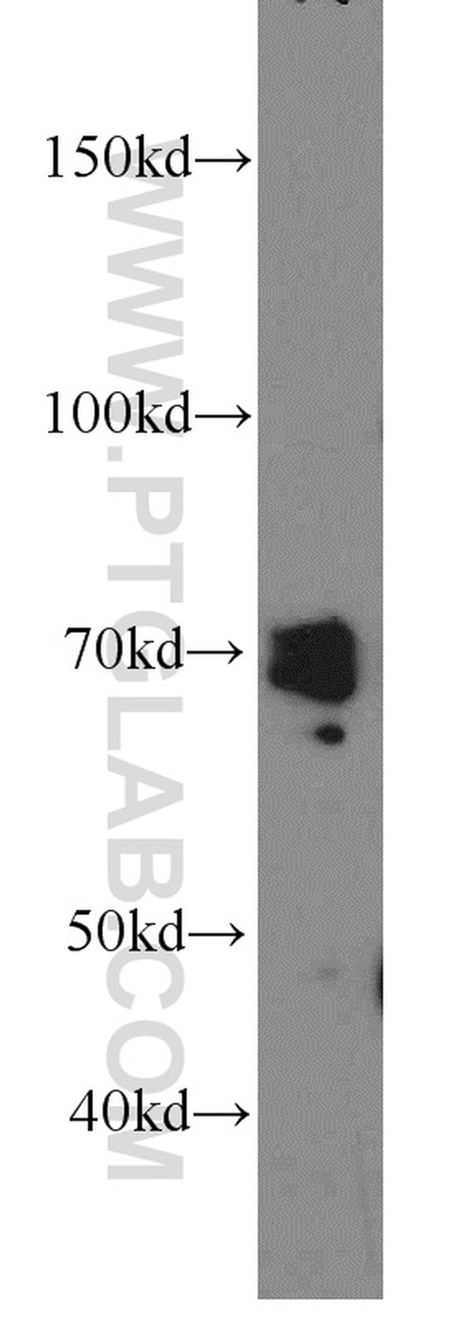 PKC delta Antibody in Western Blot (WB)