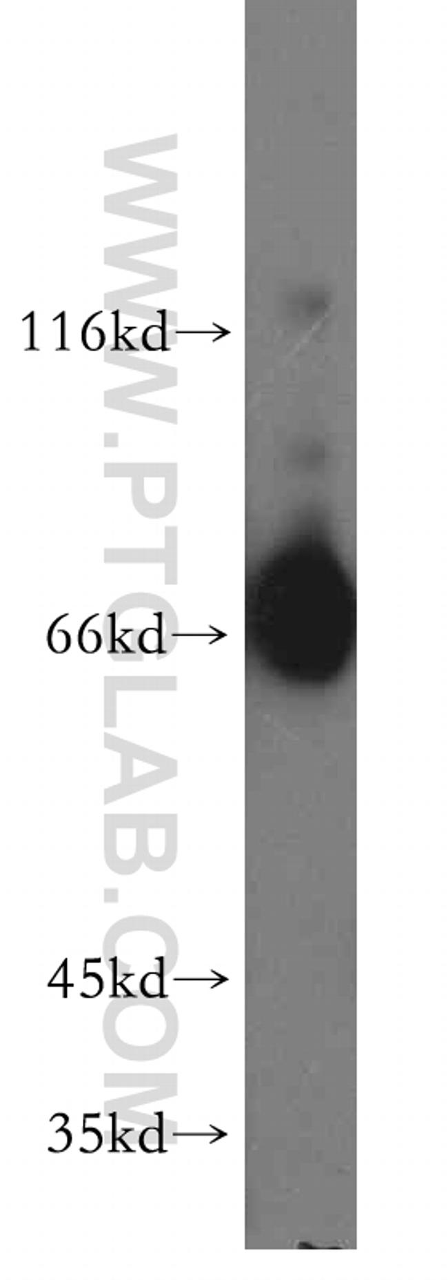 PKC delta Antibody in Western Blot (WB)