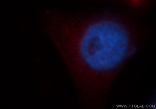 VPS11 Antibody in Immunocytochemistry (ICC/IF)