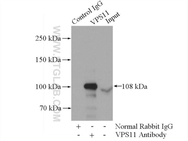 VPS11 Antibody in Immunoprecipitation (IP)
