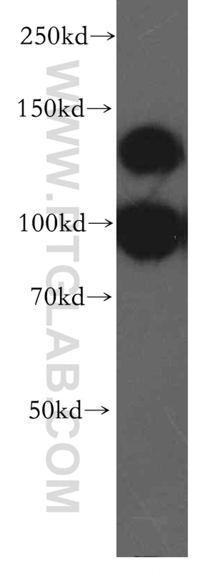 VPS11 Antibody in Western Blot (WB)