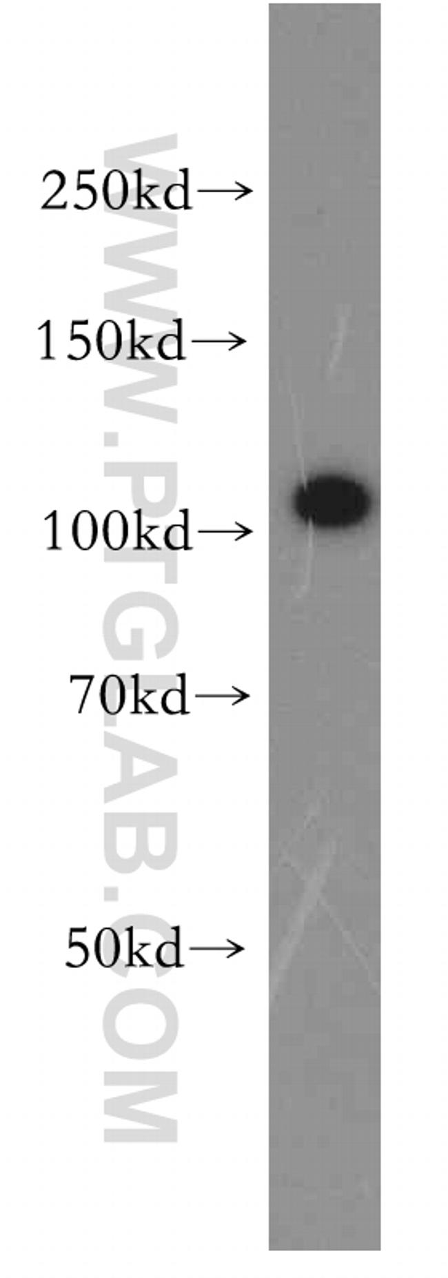 VPS11 Antibody in Western Blot (WB)