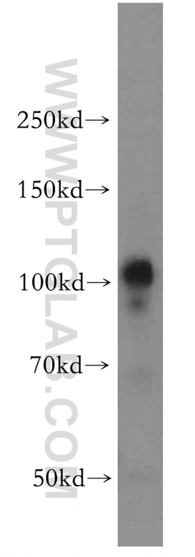 VPS11 Antibody in Western Blot (WB)