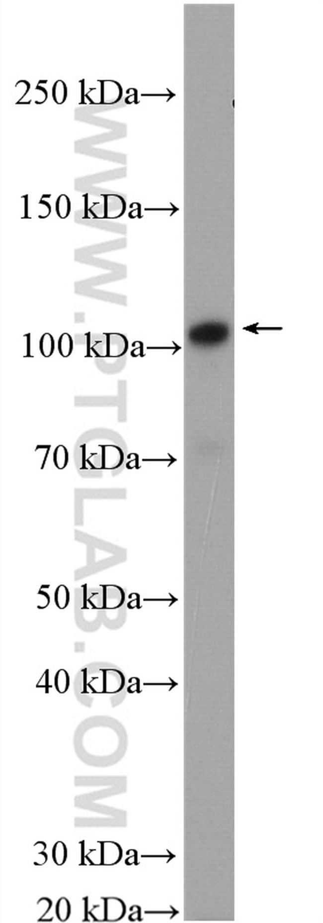 VPS11 Antibody in Western Blot (WB)