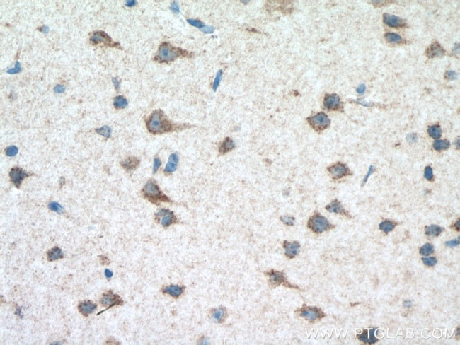 PARK9/ATP13A2 Antibody in Immunohistochemistry (Paraffin) (IHC (P))