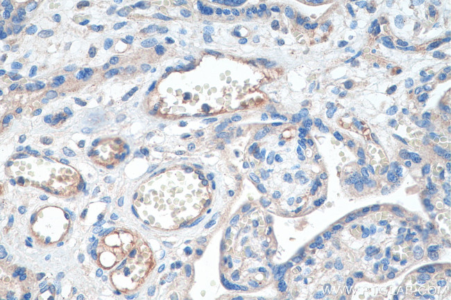 Tie2 Antibody in Immunohistochemistry (Paraffin) (IHC (P))