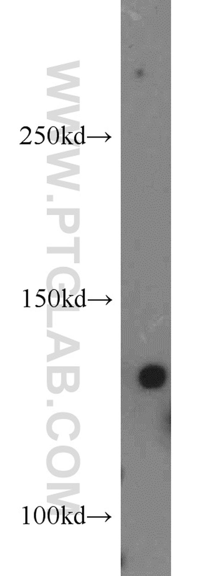 Tie2 Antibody in Western Blot (WB)