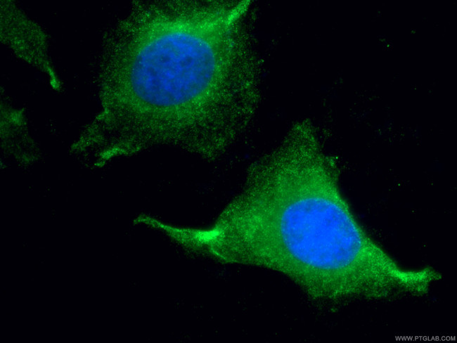 PSMB5 Antibody in Immunocytochemistry (ICC/IF)