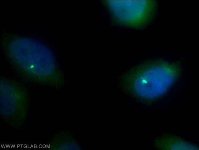 PSMB5 Antibody in Immunocytochemistry (ICC/IF)