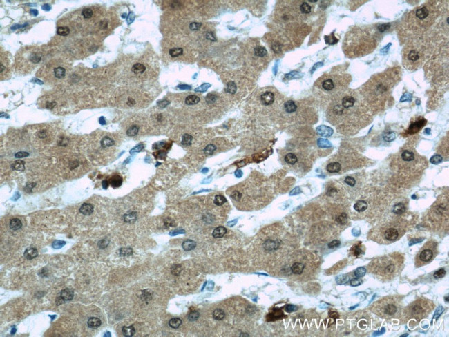 PSMB5 Antibody in Immunohistochemistry (Paraffin) (IHC (P))