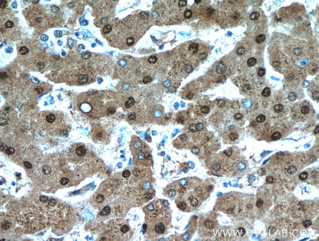 PSMB5 Antibody in Immunohistochemistry (Paraffin) (IHC (P))