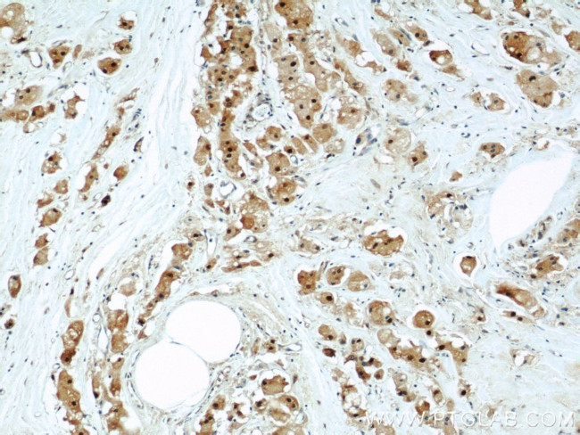 PSMB5 Antibody in Immunohistochemistry (Paraffin) (IHC (P))