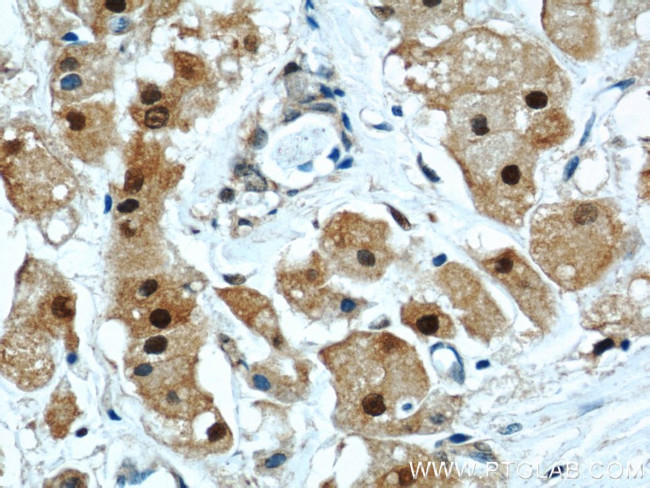 PSMB5 Antibody in Immunohistochemistry (Paraffin) (IHC (P))