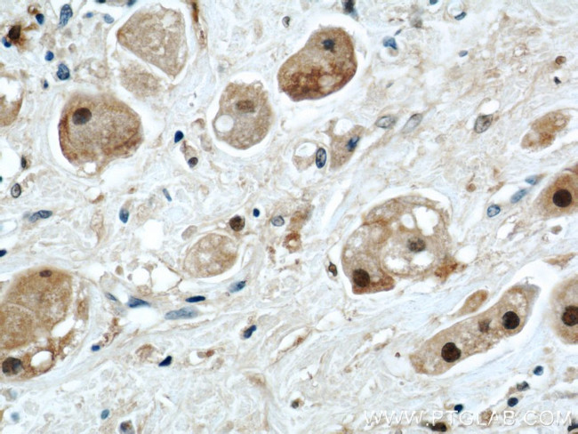 PSMB5 Antibody in Immunohistochemistry (Paraffin) (IHC (P))