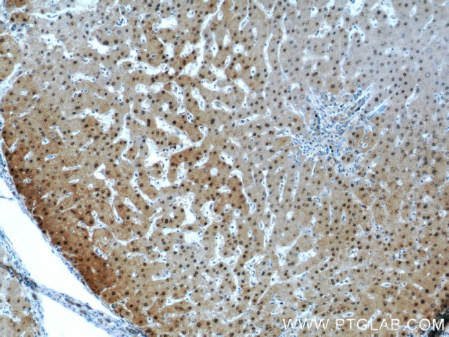 PSMB5 Antibody in Immunohistochemistry (Paraffin) (IHC (P))